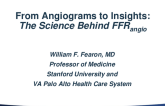 From Angiograms to Insights – The Science Behind FFRangio