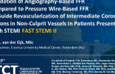 TCT 226: Validation of Coronary Angiography-Based FFR as Compared to Pressure Wire-Based FFR to Guide Revascularization of Intermediate Coronary Lesions in Non-Culprit Vessels (FAST STEMI II)