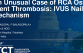 TCT 1411: Unusual Case of RCA Ostial Stent Thrombosis: IVUS Nails Mechanism