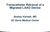 Transcatheter Retrieval of Malpositioned Left Atrial Appendage Closure Device