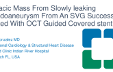TCT 908:  Thoracic Mass From Slowly Leaking Pseudoaneurysm From a Venous Bypass Graft Successfully Treated With a OCT Guided Covered Stent