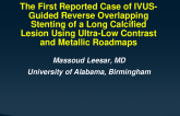 TCT 1010: The First Reported Case of IVUS-Guided Reverse Overlapping Stenting of a Long Calcified Lesion Using Ultra-Low Contrast and Metallic Roadmaps