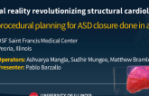 TCT 1519: Virtual Reality Revolutionizing Structural Cardiology: Pre-Procedural ASD Closure Done in a 3D Model
