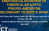 TCT 1476: Endovascular Repair of Tubercular Aortic Pseudo-Aneurysm Secondary to Pott’s Spine