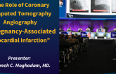 TCT 987: The Role of Coronary Computed Tomography Angiography in Pregnancy-Associated Myocardial Infarction