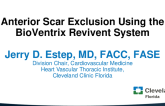 Anterior Scar Exclusion Using the BioVentrix Revivent System