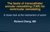 The Basis of Transcatheter Annular Restoration (TAR) for Ventricular Remodeling: A closer look at the mechanism of action