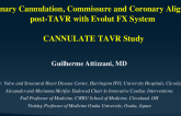 TCT 248: Assessment of Coronary Cannulation, Commissure and Coronary Alignment post TAVR with the New Supra-Annular, Self-Expanding Evolut FX System