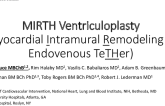 Intramyocardial Cinching of the Dilated LV: The MIRTH Approach