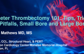 Catheter Thrombectomy 101: Tips, Tricks, and Pitfalls, Small Bore and Large Bore