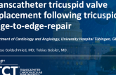 TCT 1211: Transcatheter Tricuspid Valve Replacement in a Patient After Failed Tricuspid TEER With a TriClip Attached to the Anterior/Septal Leaflet