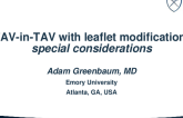 Leaflet Modification for TAV-in-TAV