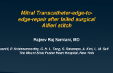 Mitral Transcatheter-Edge-to-Edge-Repair After Failed Surgical Alfieri Stitch