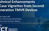 Technical Enhancements and Case Vignettes from Second Generation TMVR Devices