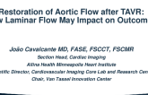 Restoration of flow from CMR: Laminar Flow Impact on Outcomes