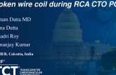 TCT 1462: Broken Wire Coil During RCA CTO PCI
