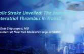 Embolic Stroke Unveiled: The Journey of an Interatrial Thrombus in Transit