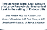 Percutaneous Mitral Leak Closure of a Large Paravalvular Mechanical Leak in the Setting of Endocarditis