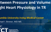 Between Pressure and Volume: Right Heart Physiology in TR