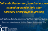 TCT 1266: Coil Embolization for Pseudoaneurysm Caused by Needle Hole After Coronary Artery Bypass Grafting