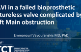 TCT 1187: Transcatheter Aortic Valve Implantation in a Failed Bioprosthetic Sutureless Valve Complicated by Left Main Obstruction