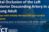 TCT 1429: Total Occlusion of the Left Anterior Descending Artery in a Young Adult: A Case With Initially Normal EKG and Cardiac Enzymes