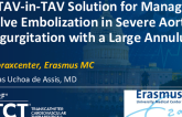 TCT 1560: A TAVI-in-TAVI Solution for Managing Valve Embolization in Severe Aortic Regurgitation With Large Annulus