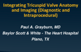 Integrating Tricuspid Valve Anatomy and Imaging (Diagnostic and Intraprocedure)