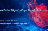 Case: Transcatheter Edge-to-Edge Repair  in Acute MR