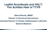 Leaflet Thrombosis and HALT: The Achilles Heel of TTVR?