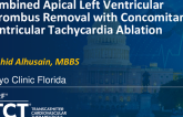 TCT 1543: Combined Apical Left Ventricular Thrombus Removal With Concomitant Ventricular Tachycardia Ablation