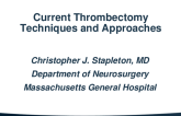 Current Thrombectomy Techniques and Approaches