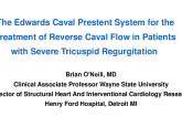 The Edwards Caval Pre-stent TTVR System
