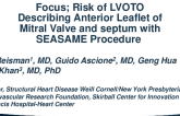 Risk of LVOTO Describing Anterior Leaflet of Mitral Valve with Discussion