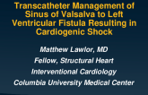 Transcatheter Management of Sinus of Valsalva to Left Ventricular Fistula Resulting in Cardiogenic Shock