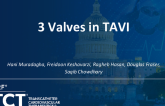 TCT 1387: 3 Valves in TAVI