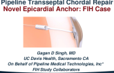 Transseptal Chordal Repair with a Novel Epicardial Anchor: A First-in-Human Case Study