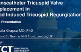 Case 1: TTVI in Lead Induced TR: Assessment and Management