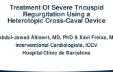 Treatment Of Severe Tricuspid Regurgitation Using a Heterotopic Cross-Caval Device