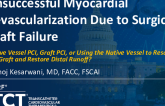 TCT 1229: Failed Myocardial Revascularization Due to Surgical Graft Failure: Native Vessel PCI, Graft PCI, or Using the Native Vessel to Rescue the Graft and Restore Distal Runoff?