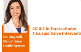 4D ICE Imaging of the Tricuspid Valve
