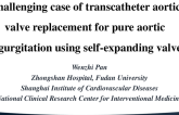 TCT 1289: Challenged Case of Transcatheter Aortic Valve Replacement for Pure Aortic Regurgitation Using Self-Expanding Valve