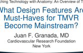What Design Features Are Must-Haves for TMVR to Become Mainstream?