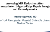 Assessing MR Reduction After Transcatheter Edge-to-Edge Repair Imaging and Hemodynamics