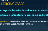 TCT 935: Retrograde fenestration of a covered stent after Left main-left anterior descending perforation