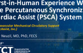 TCT 586: First-in-Human Experience With the Percutaneous Synchronized Cardiac Assist (PSCA) System: Extravascular Mechanical Circulatory Support