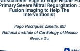 Transcatheter Edge to Edge Repair for Primary Severe Mitral Regurgitation: Fusion Imaging to Help the Interventionist