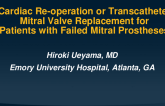 TCT 246: Nationally Representative Outcomes of Redo Surgical and Transcatheter Mitral Valve Replacement in Failed Mitral Bioprostheses