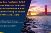 TCT 799: Enhanced Stent Visualization Guided Intravascular Lithotripsy for Severely Calcified Coronary Lesions: A Novel Technique for Advancing IVL Balloons in Uncrossable Lesions