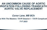 An Uncommon Cause of Aortic Regurgitation Following Transcatheter Aortic Valve Replacement